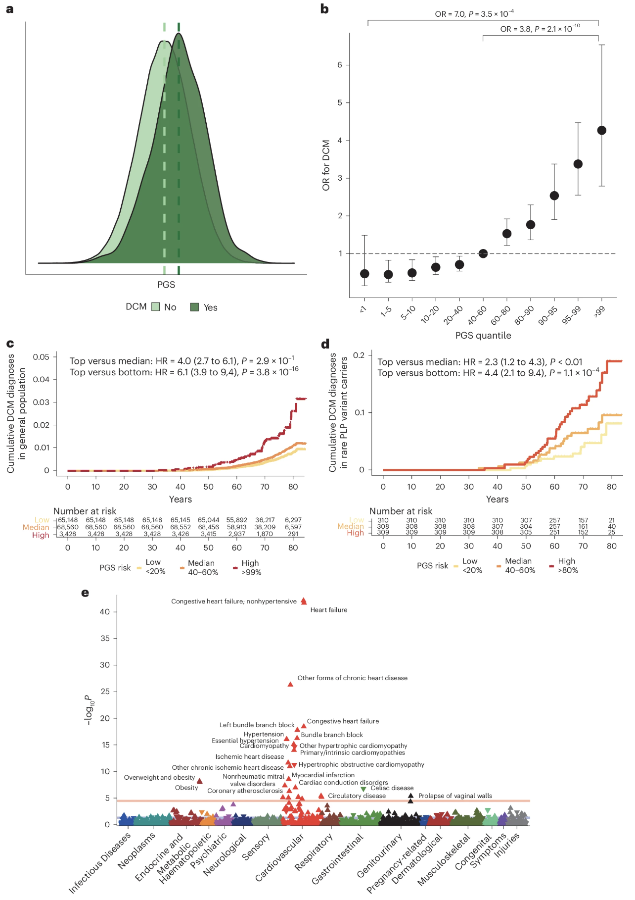 DCM polygenic score predicts disease in UK Biobank
