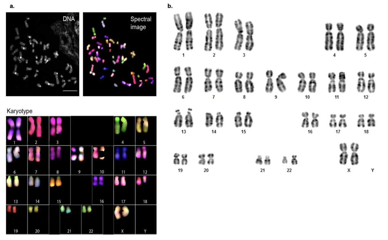 CHM13 karyotype confirmed by SKY and G-banding